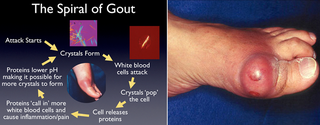 Pre-revenue stage manufacturing company produces juice for gout patients, hymen tightening spray, wound healing spray.